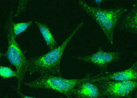 Anti-Human TNFRSF1A Antibody [B273] - ABMIUM