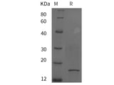 SDS-PAGE analysis of Rat IL2/IL-2/Interleukin-2 proteins, 2 μg/lane of Recombinant Rat IL2/IL-2/Interleukin-2 proteins was resolved with SDS-PAGE under reducing conditions, showing bands at 15 kDa.