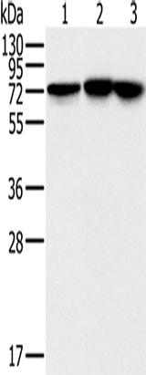 Anti-Human/Mouse/Rat NDUFS1 Antibody - ABMIUM