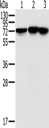 Anti-Human/Mouse/Rat NDUFS1 Antibody - ABMIUM