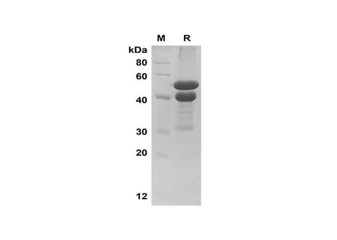 SDS-PAGE analysis of Bovine FGG/Fibrinogen gamma chain proteins, 2 μg/lane of Recombinant Bovine FGG/Fibrinogen gamma chain proteins was resolved with SDS-PAGE under reducing conditions, showing bands at 40-50 kDa.