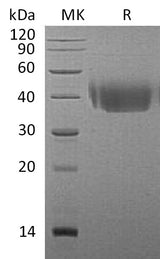 Recombinant Mouse CD226/DNAM-1 Protein (His Tag) - ABMIUM
