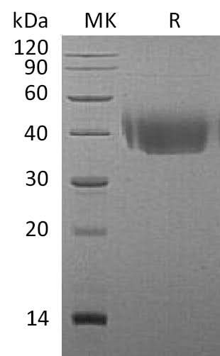 Recombinant Mouse CD226/DNAM-1 Protein (His Tag) - ABMIUM