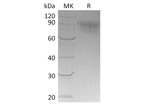 Recombinant Cynomolgus SIGLEC5/CD170 Protein (His Tag) - ABMIUM