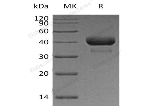 Recombinant Human Cathepsin B/CTSB Protein (His Tag) - ABMIUM