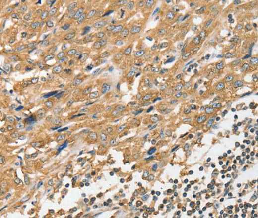 Anti-Human/Mouse ANGPTL7 Antibody