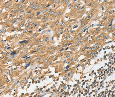 Anti-Human/Mouse ANGPTL7 Antibody - ABMIUM