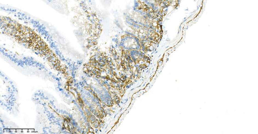 Anti-Human/Mouse/Rat CD44 Antibody [B875] - ABMIUM