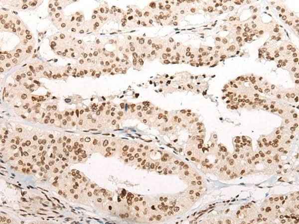 Anti-Human/Mouse VPS51 Antibody