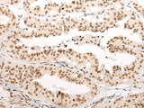 Anti-Human/Mouse VPS51 Antibody - ABMIUM