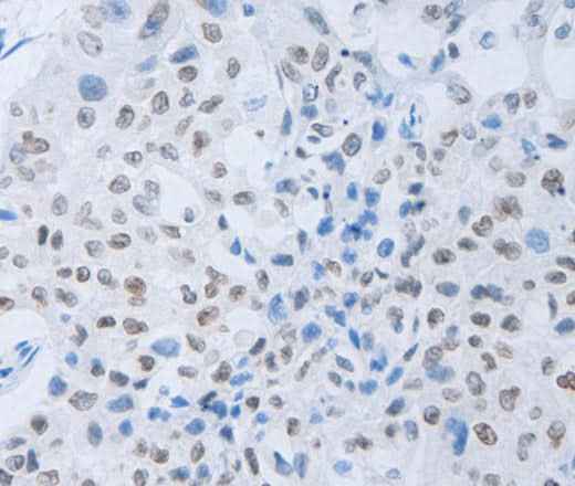Anti-Human/Mouse/Rat c-Fms Antibody