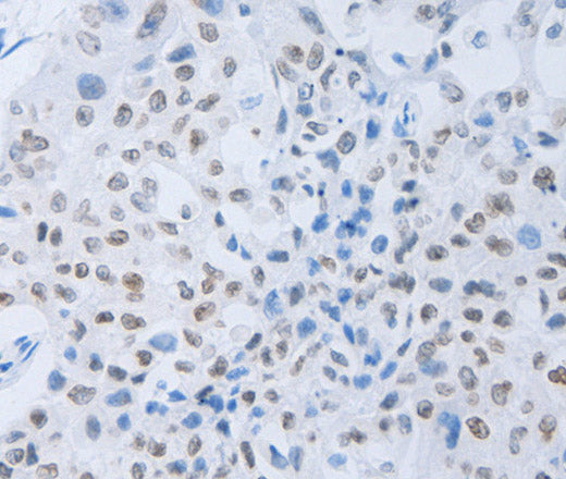 Anti-Human/Mouse/Rat c-Fms Antibody - ABMIUM