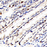 Immunohistochemistry analysis of paraffin-embedded mouse colon using RELB Polyclonal Antibody at dilution of 1:400.