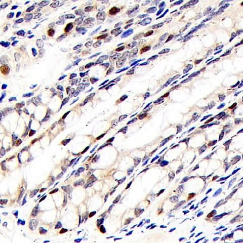 Immunohistochemistry analysis of paraffin-embedded mouse colon using RELB Polyclonal Antibody at dilution of 1:400.