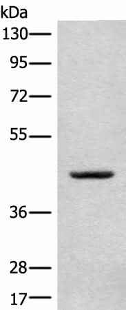 Anti-Human/Mouse/Rat CANT1 Antibody