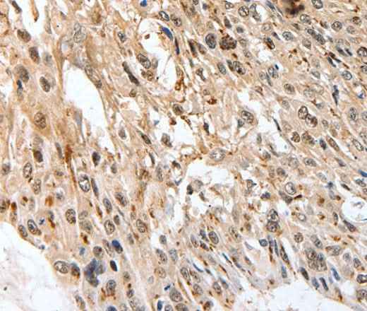 Anti-Human/Mouse SLC1A7 Antibody