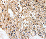 Anti-Human/Mouse SLC1A7 Antibody - ABMIUM