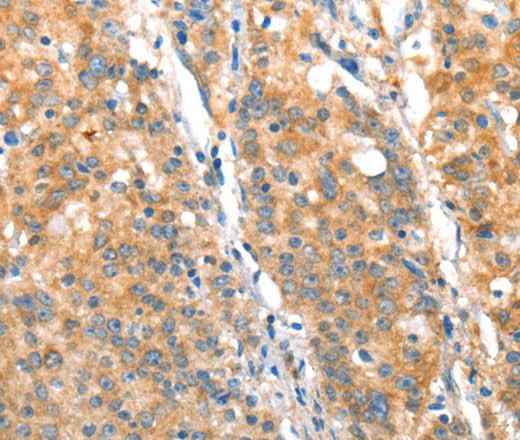 Anti-Human/Mouse ST14 Antibody