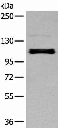 Anti-Human/Mouse ZNF281 Antibody