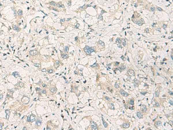 Anti-Human/Mouse/Rat SPSB2 Antibody