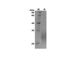 SDS-PAGE analysis of Rat IL-5 proteins, 2 μg/lane of Recombinant Rat IL-5 proteins was resolved with SDS-PAGE under reducing conditions, showing bands at 20-28 kDa.