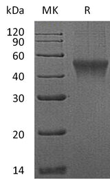 Recombinant Mouse FCRL1 Protein (aa 17-219, His Tag) - ABMIUM