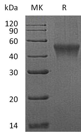 Recombinant Mouse FCRL1 Protein (aa 17-219, His Tag) - ABMIUM