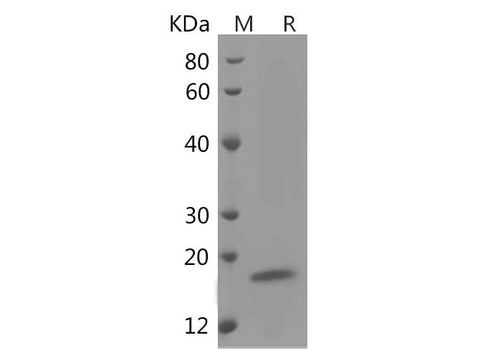 SDS-PAGE analysis of Human Interleukin-4/IL-4 proteins, 2 μg/lane of Recombinant Human Interleukin-4/IL-4 proteins was resolved with SDS-PAGE under reducing conditions, showing bands at 16 kDa.