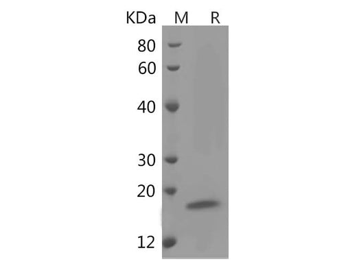 SDS-PAGE analysis of Human Interleukin-4/IL-4 proteins, 2 μg/lane of Recombinant Human Interleukin-4/IL-4 proteins was resolved with SDS-PAGE under reducing conditions, showing bands at 16 kDa.