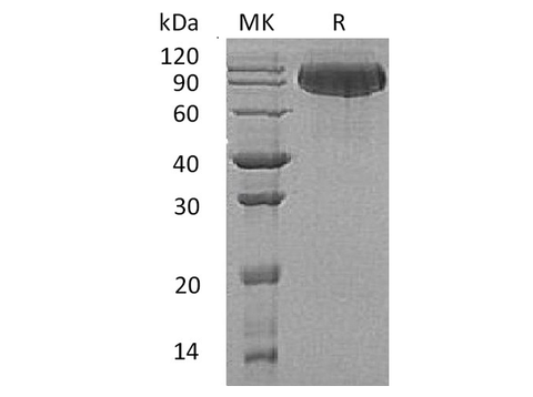 Recombinant Human Butyrylcholinesterase/BCHE Protein (His Tag) - ABMIUM