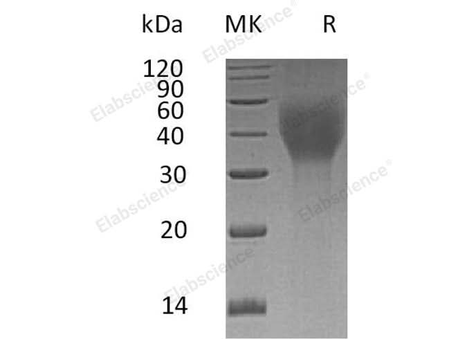 Recombinant Human TCblR/8D6A Protein (His Tag) - ABMIUM