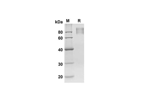 SDS-PAGE analysis of Human KIT/SCFR proteins, 2 μg/lane of Recombinant Human KIT/SCFR proteins was resolved with SDS-PAGE under reducing conditions, showing bands at 54.7 kDa.