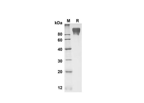 SDS-PAGE analysis of Mouse CEACAM-1/CD66a proteins , 2 μg/lane of Recombinant Mouse CEACAM-1/CD66a proteins was resolved with SDS-PAGE under reducing conditions , showing bands at 90 kDa.