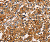 Anti-Human CDC25B Antibody - ABMIUM