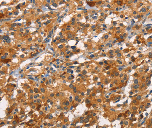 Anti-Human CDC25B Antibody - ABMIUM