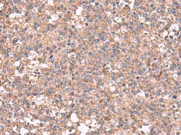 Anti-Human MAPK8IP3 Antibody