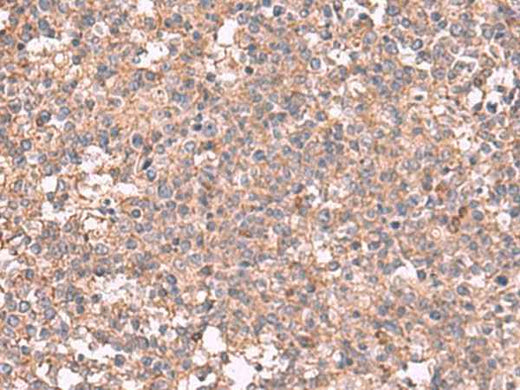 Anti-Human MAPK8IP3 Antibody