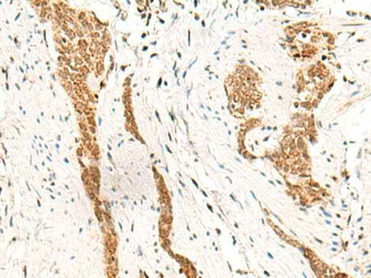 Anti-Human/Mouse HOXC13 Antibody