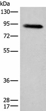Western blot analysis of Human plasma solution using C1R Polyclonal Antibody at dilution of 1:800