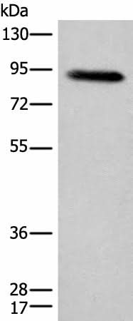Western blot analysis of Human plasma solution using C1R Polyclonal Antibody at dilution of 1:800