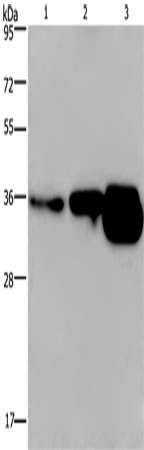 Anti-Human/Mouse CUEDC2 Antibody - ABMIUM