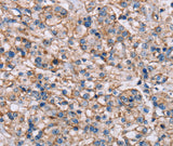 Anti-Human/Mouse ADAM12 Antibody - ABMIUM
