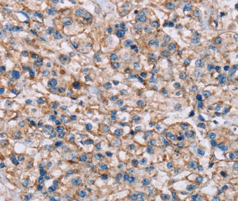 Anti-Human/Mouse ADAM12 Antibody - ABMIUM