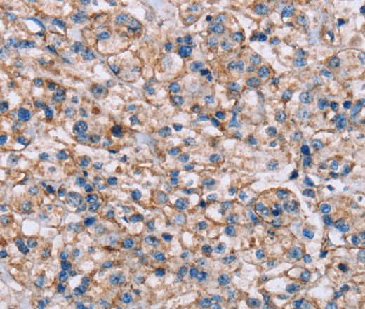 Anti-Human/Mouse ADAM12 Antibody - ABMIUM