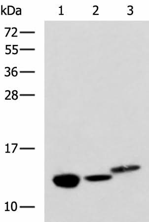 Western blot analysis of Rat kidney tissue Mouse liver tissue and Human fetal liver tissue lysates using RIDA Polyclonal Antibody at dilution of 1:600