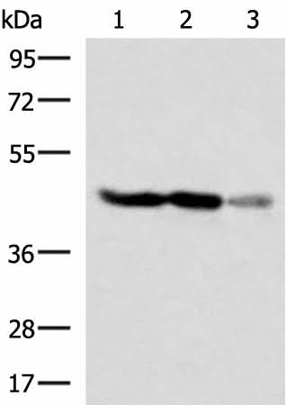 Western blot analysis of HT29 and HepG2 cell Human fetal brain tissue lysates using FDFT1 Polyclonal Antibody at dilution of 1:1000