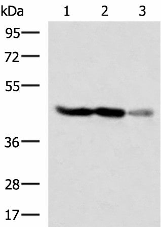 Western blot analysis of HT29 and HepG2 cell Human fetal brain tissue lysates using FDFT1 Polyclonal Antibody at dilution of 1:1000