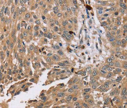 Anti-Human/Mouse/Rat PDLIM7 Antibody