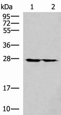 Anti-Human/Mouse/Rat MRPL16 Antibody