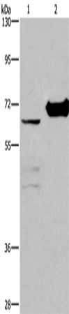 Anti-Human/Mouse/Rat CHDH Antibody - ABMIUM